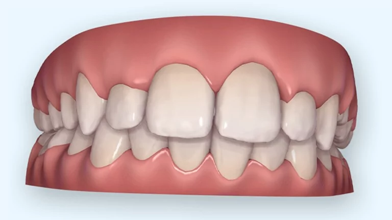 יישור שיניים ולסתות