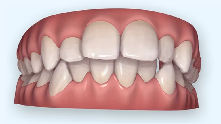 יישור שיניים ולסתות
