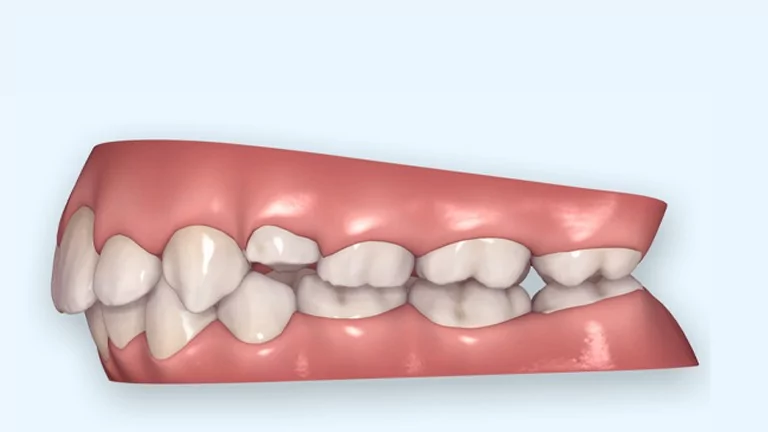 יישור שיניים ולסתות