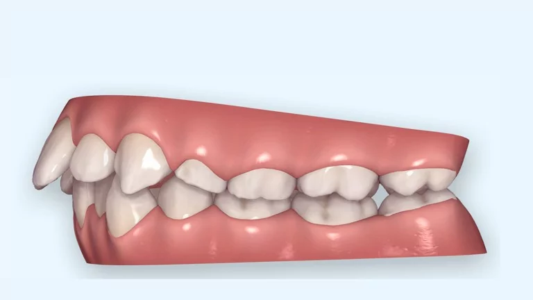 יישור שיניים ולסתות