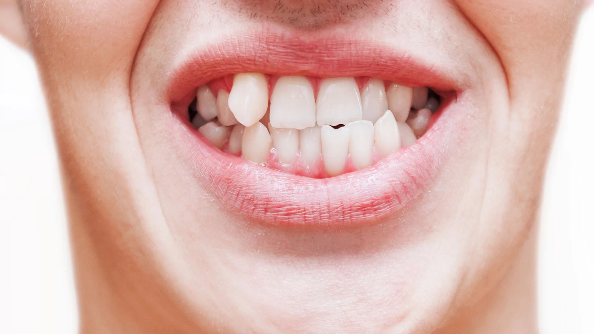 יישור שיניים ולסתות