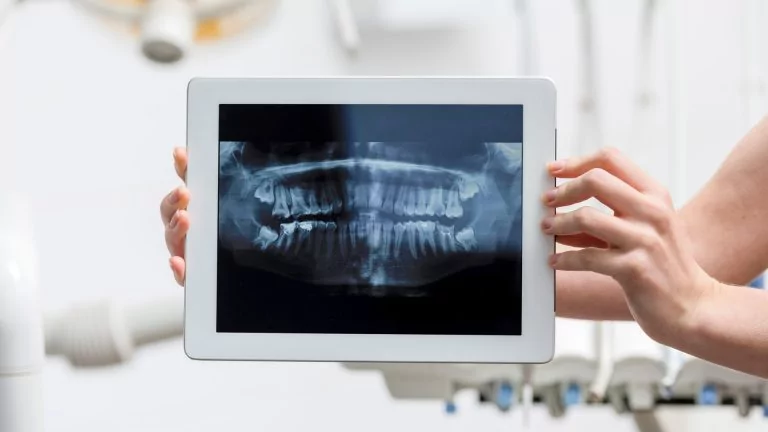 צילום דנטלי